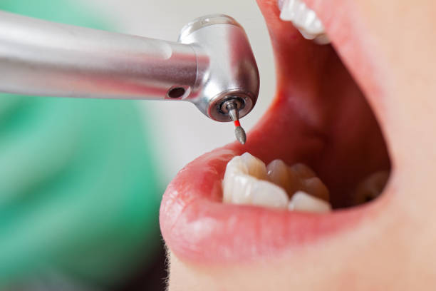 Best Emergency Treatment for Toothache in Warsaw, KY